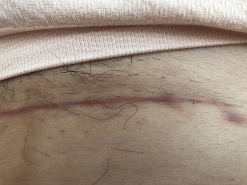 女性健康体脂率，你了解多少？